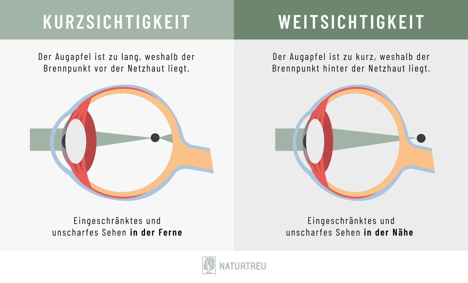 Kurzsichtigkeit und Weitsichtigkeit im Vergleich 